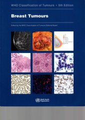 book Breast Tumours: WHO Classification of Tumours (Medicine)