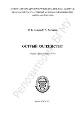 book Острый холецистит