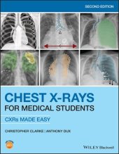 book Chest X-Rays for Medical Students: CXRs Made Easy