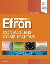 book Contact Lens Complications