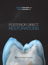 book Posterior Direct Restorations