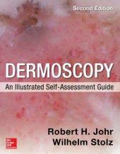 book Dermoscopy: An Illustrated Self-Assessment Guide, 2/E