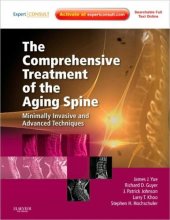 book The Comprehensive Treatment of the Aging Spine. Minimally Invasive and Advanced Techniques