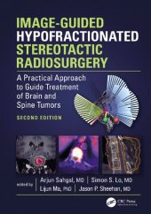 book Image-Guided Hypofractionated Stereotactic Radiosurgery: A Practical Approach to Guide Treatment of Brain and Spine Tumors