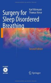 book Surgery for Sleep Disordered Breathing