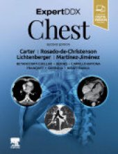 book ExpertDDx: Chest