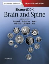 book ExpertDDx: Brain and Spine