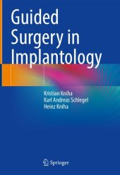 book Guided Surgery in Implantology