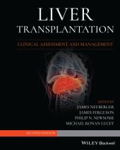 book Liver Transplantation: Clinical Assessment and Management