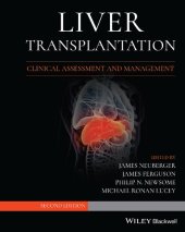 book Liver Transplantation: Clinical Assessment and Management