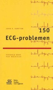 book 150 ECG-problemen