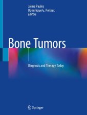 book Bone Tumors. Diagnosis and Therapy Today