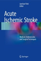 book Acute Ischemic Stroke. Medical, Endovascular, and Surgical Techniques