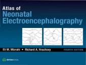 book Atlas of neonatal electroencephalography