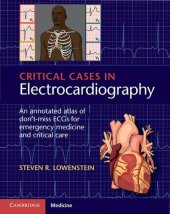 book Critical Cases in Electrocardiography. An Annotated Atlas of Don’t-Miss ECGs for Emergency Medicine and Critical Care