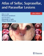 book Atlas of Sellar, Suprasellar, and Parasellar Lesions