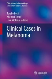 book Clinical cases in melanoma