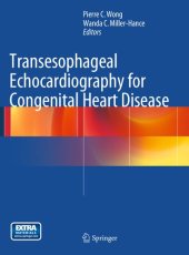 book Transesophageal Echocardiography for Congenital Heart Disease