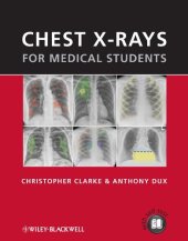 book Chest X-rays for Medical Students