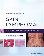 book Skin lymphoma. The illustrated guide