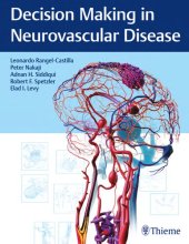 book Decision making in neurovascular disease