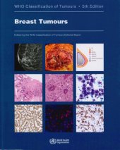 book Breast Tumours: WHO Classification of Tumours