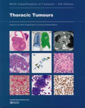 book Thoracic Tumours: WHO Classification of Tumours