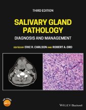 book Salivary Gland Pathology: Diagnosis and Management