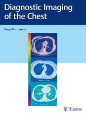 book Diagnostic Imaging of the Chest