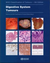 book Digestive System Tumours: WHO Classification of Tumours