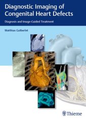 book Diagnostic Imaging of Congenital Heart Defects: Diagnosis and Image-Guided Treatment