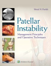 book Patellar Instability: Management Principles and Operative Techniques