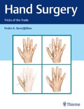 book Hand Surgery: Tricks of the Trade