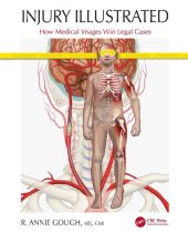 book Injury Illustrated: How Medical Images Win Legal Cases