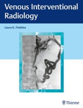 book Venous Interventional Radiology