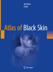 book Atlas of Black Skin