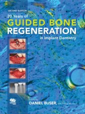 book 20 Years of Guided Bone Regeneration in Implant Dentistry