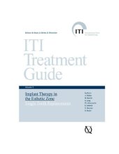 book ITI treatment guide, Vol 1: Implant Therapy in the Esthetic Zone: Single-Tooth Replacements