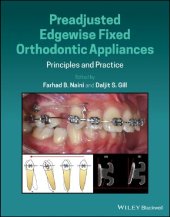 book Preadjusted Edgewise Fixed Orthodontic Appliances: Principles and Practice