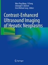 book Contrast-Enhanced Ultrasound Imaging of Hepatic Neoplasms