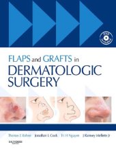 book Flaps and Grafts in Dermatologic Surgery: Text with DVD