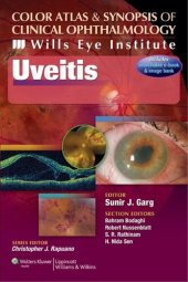 book Uveitis: Color Atlas and Synopsis of Clinical Ophthalmology (Wills Eye Institute Atlas Series)