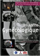 book Syllabus Imagerie Gynécologique