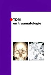 book TDM en traumatologie (Imagerie médicale : diagnostic) (French Edition)