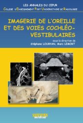 book Imagerie de l'oreille et des voies cochléo-vestibulaires