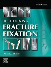 book The Elements of Fracture Fixation