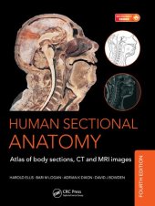 book Human sectional anatomy : atlas of body sections, CT and MRI images