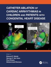 book Catheter Ablation of Cardiac Arrhythmias in Children and Patients with Congenital Heart Disease