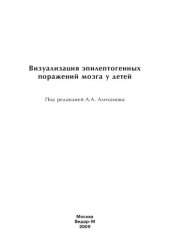 book Визуализация эпилептогенных поражений мозга у детей