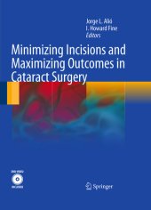 book Minimizing Incisions and Maximizing Outcomes in Cataract Surgery